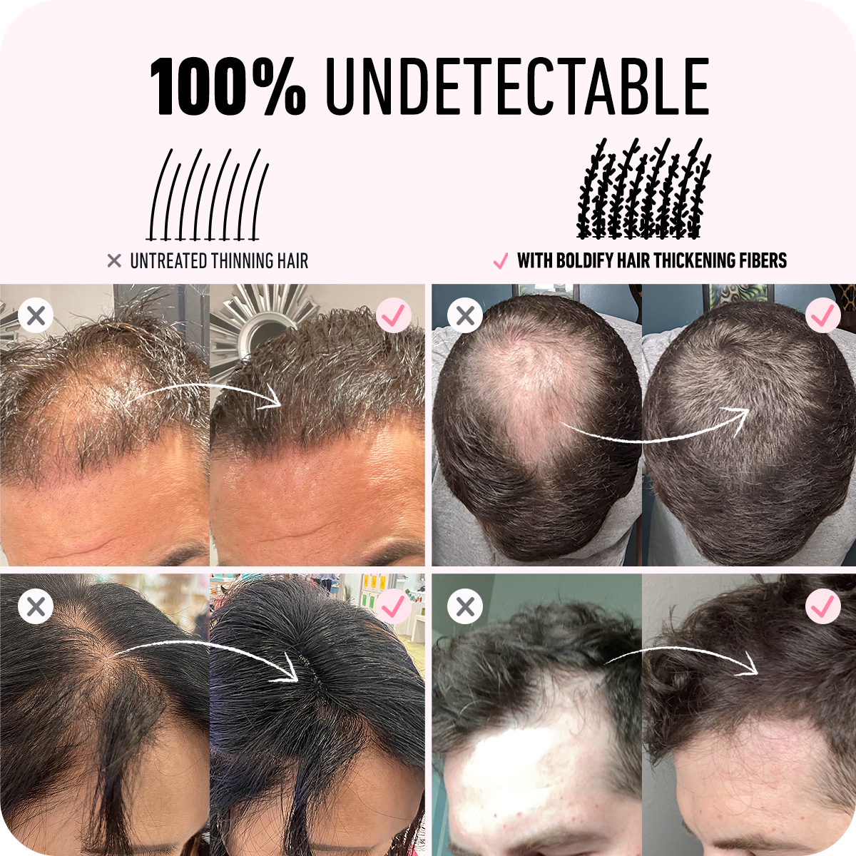 100% Undetectable BOLDIFY Hair Thickening Fibers