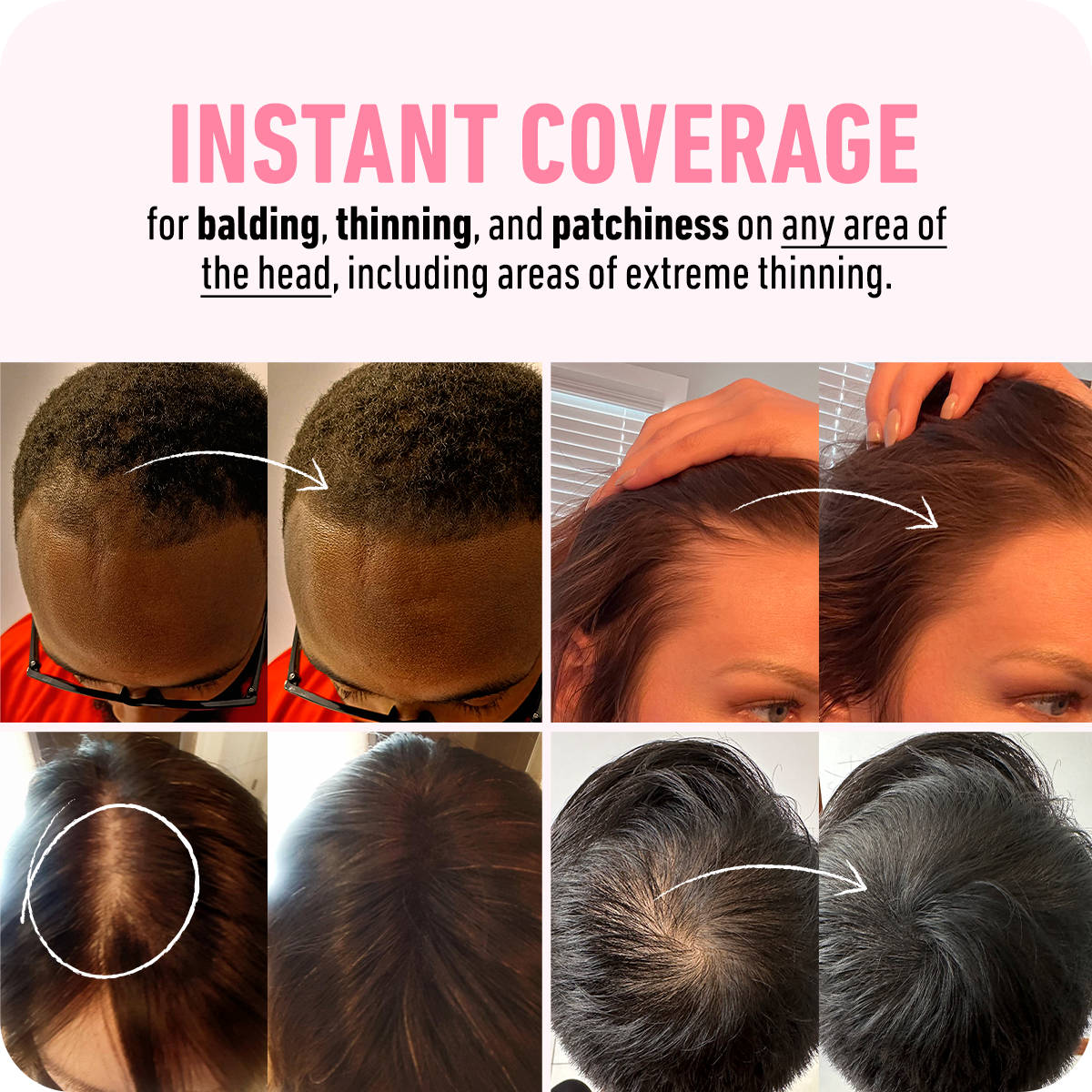 Instant Coverage With Boldify hair thickening fibers