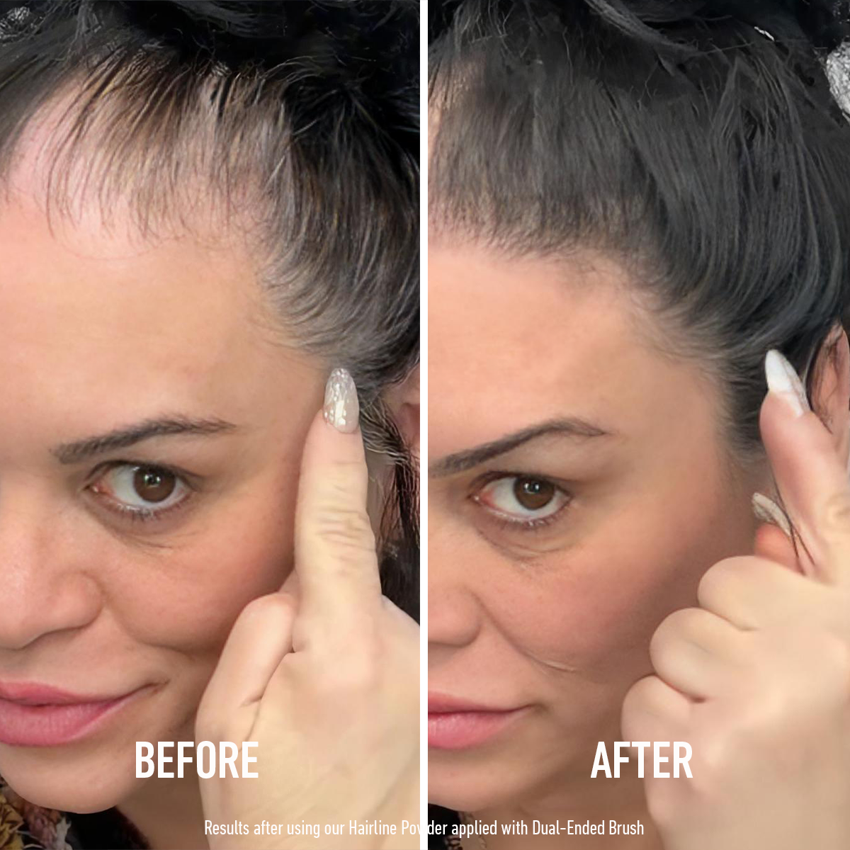 Before and After