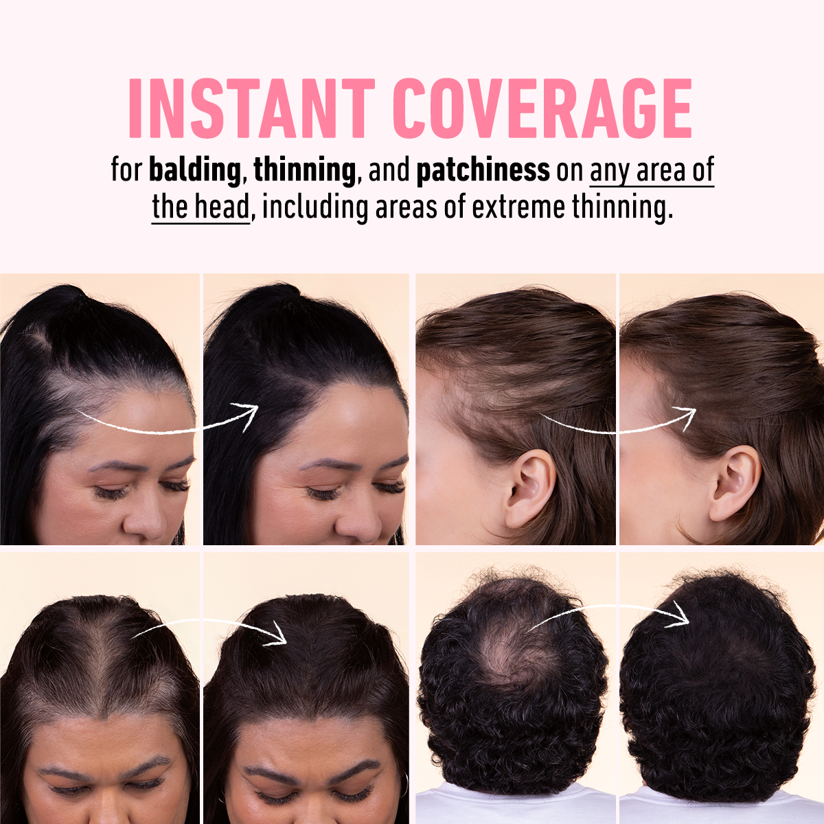 Hairline Powder Starter Kit - Your All-In-One Kit for Flawless Roots, a Fuller Hairline, and Instant Confidence