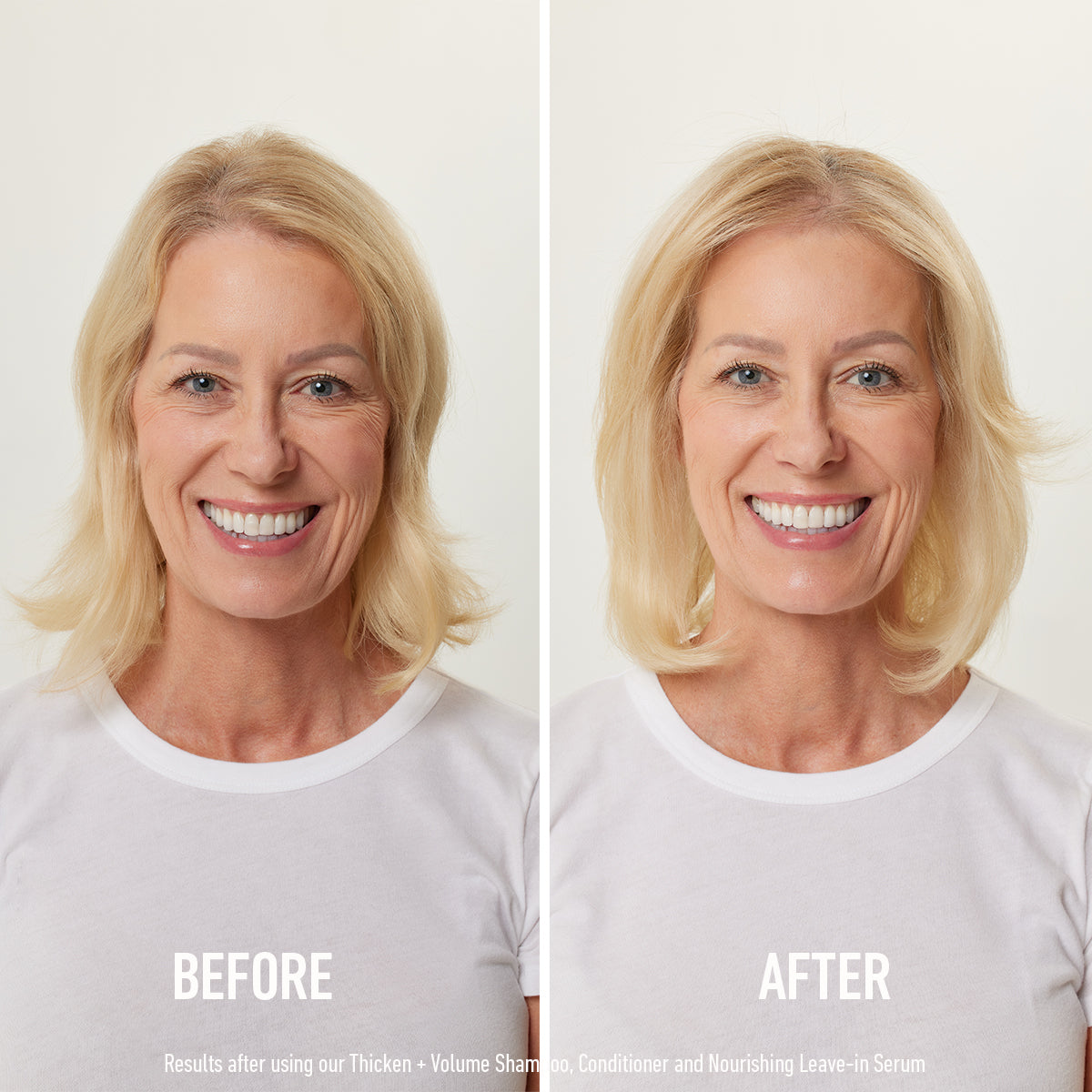 Serum Before & After
