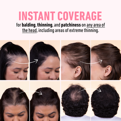 Hairline Powder Starter Kit - Your All-In-One Kit for Flawless Roots, a Fuller Hairline, and Instant Confidence